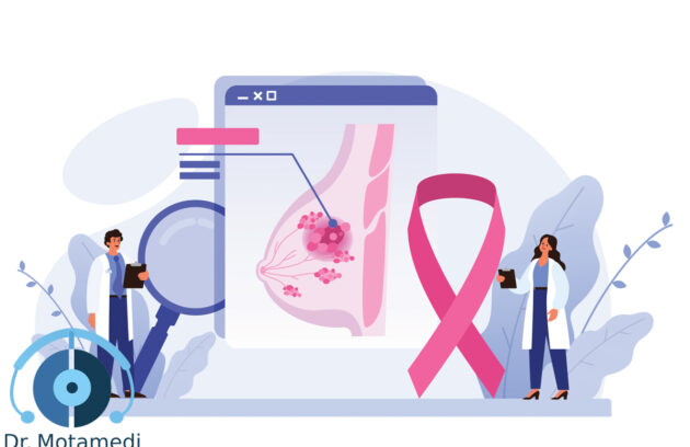 سرطان پستان