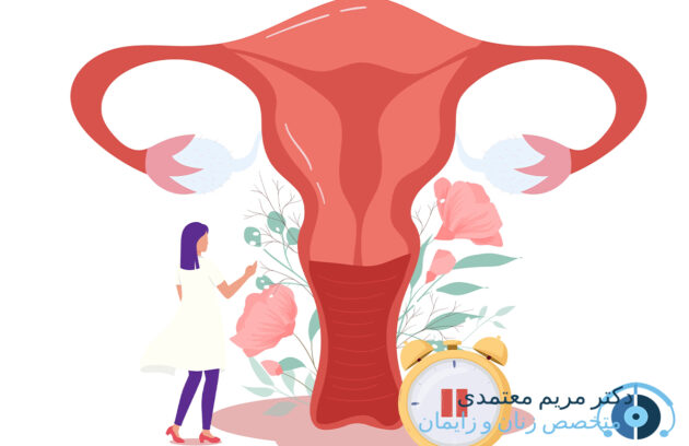 تنبلی تخمدان