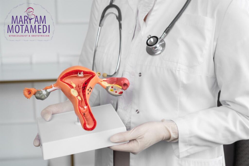 افتادگی رحم