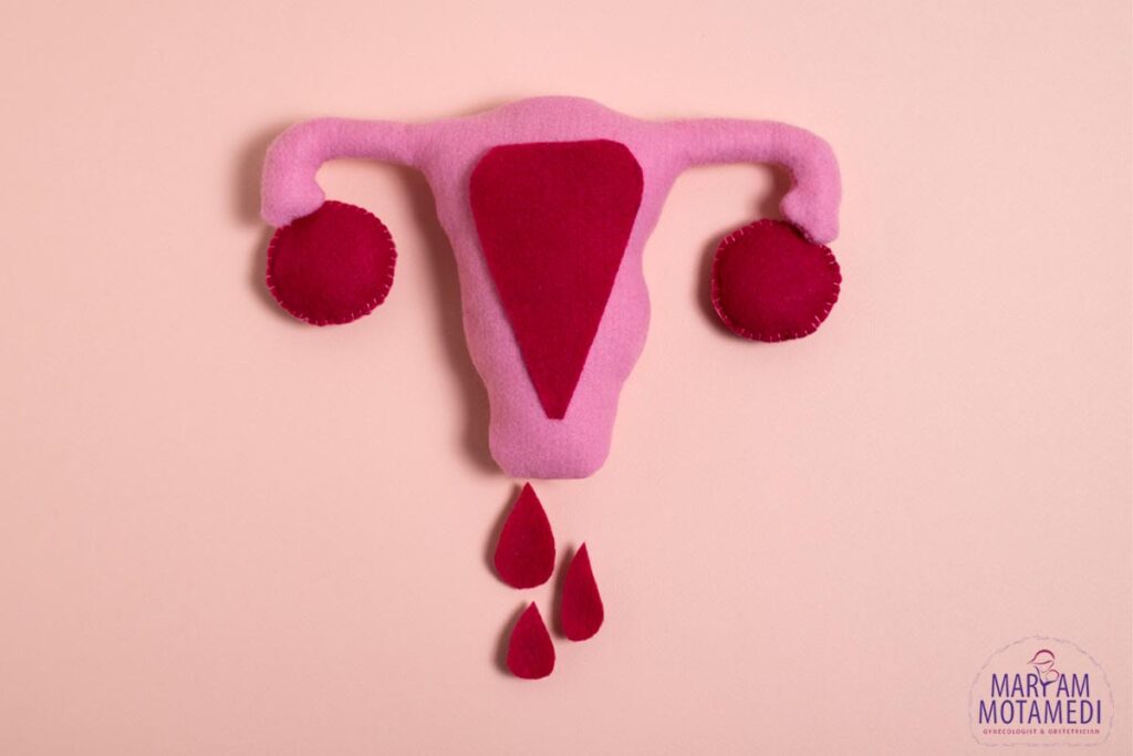 خون ریزی در دوران پریود