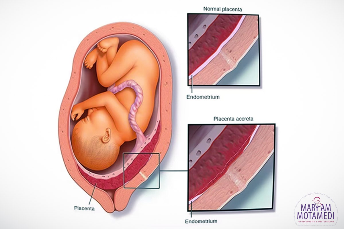 چسبندگی جفت